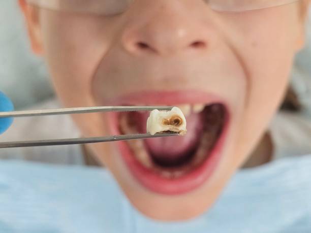 Best 24-Hour Emergency Dentist in Girard, IL